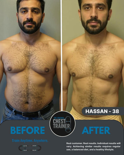 ChestTrainer ™